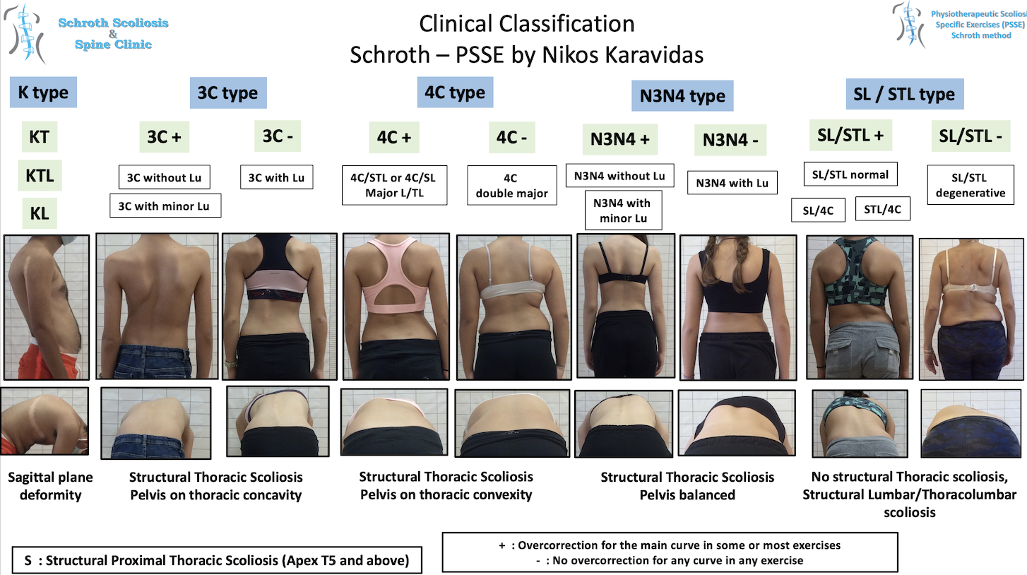 Clinical classification PSSE Schroth by Nikos Karavidas