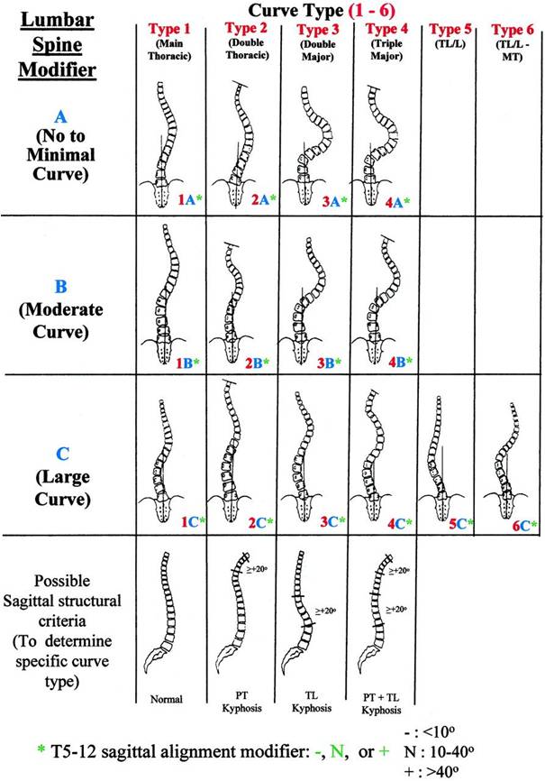 Η ταξινόμηση της σκολίωσης κατά Lenke Lenke classification