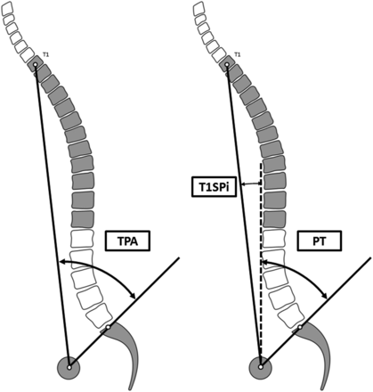Μέτρηση του TPA και του T1Spi TPA T1Spi
