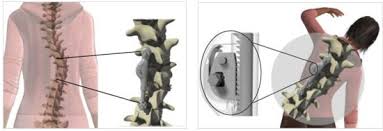 ApiFix concept Apifix system