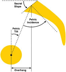 PI= PT +SS pelvic incidence