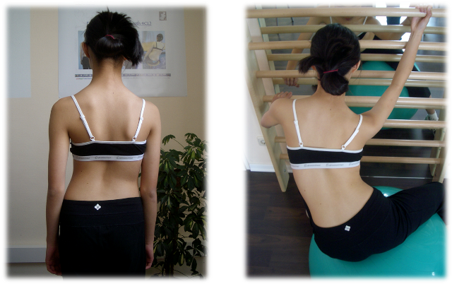 50 times schroth exercise