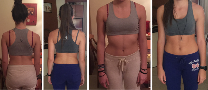 Soumpasi photos 7 months after Schroth BSPTS