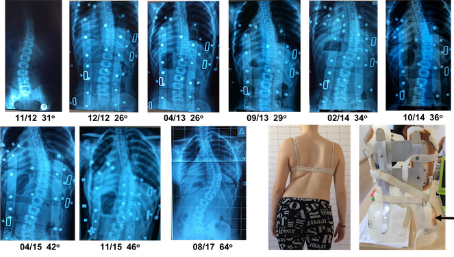 Preka DDB bad treatment result